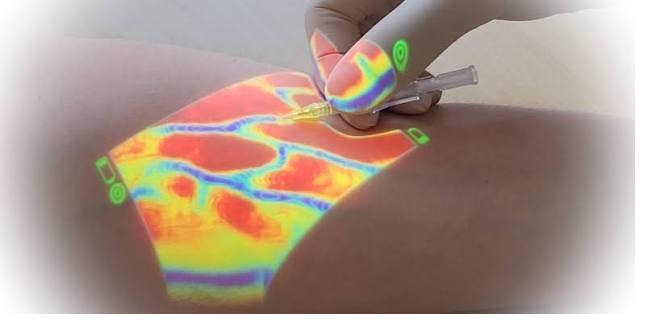 Vein Finder